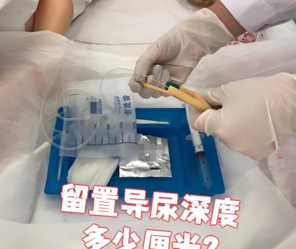 避孕套能用于导尿吗？